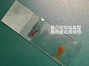 弹力果冻血型奥秘揭秘：血液健康新探与临床应用