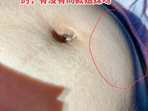 戳的肚子都鼓起来了、什么东西一直戳我的肚子，都戳得肚子鼓起来了？